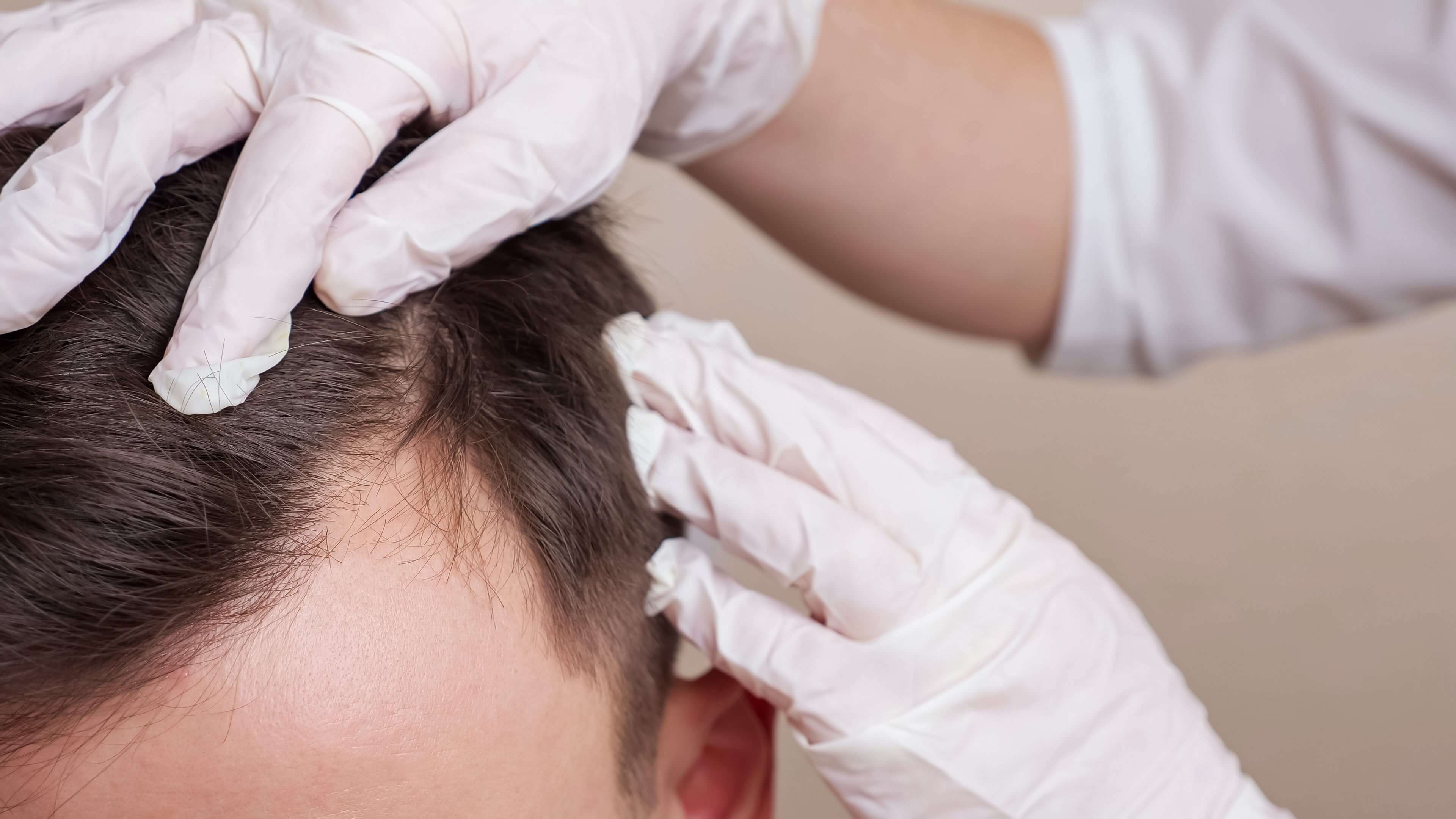 Gloved hands inspecting a person's scalp.