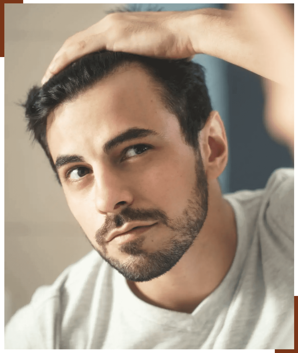 Natural hairline result from professional men’s hair replacement.
